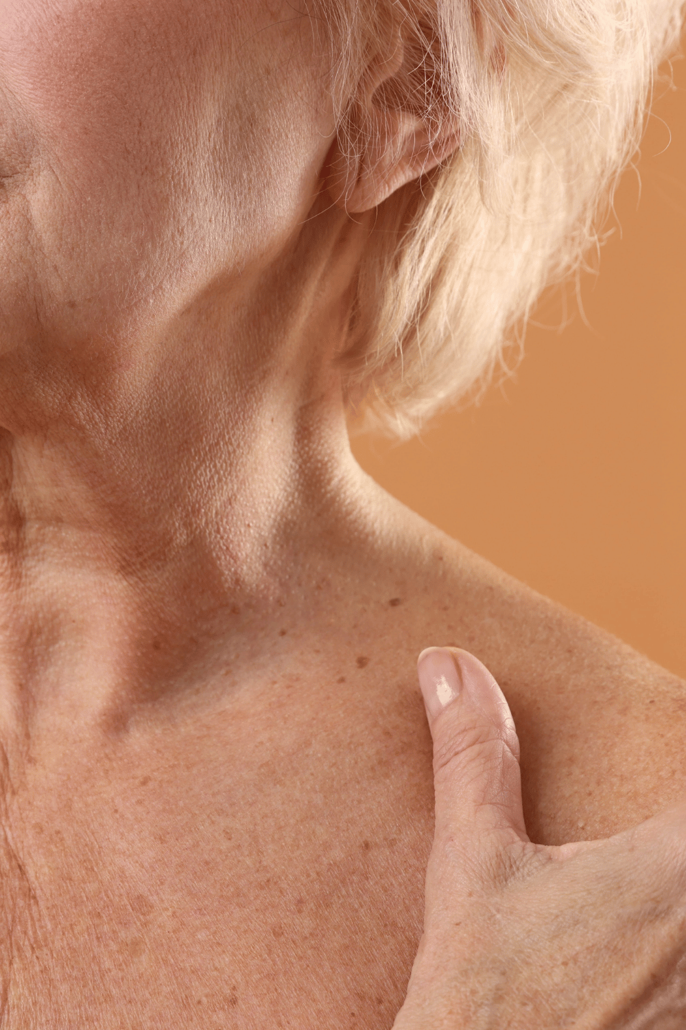 Why Your Skin Suddenly Looks Like Crepe Paper — and What to Do About It