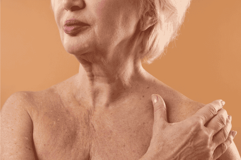 older woman showing crepey skin on neck & chest