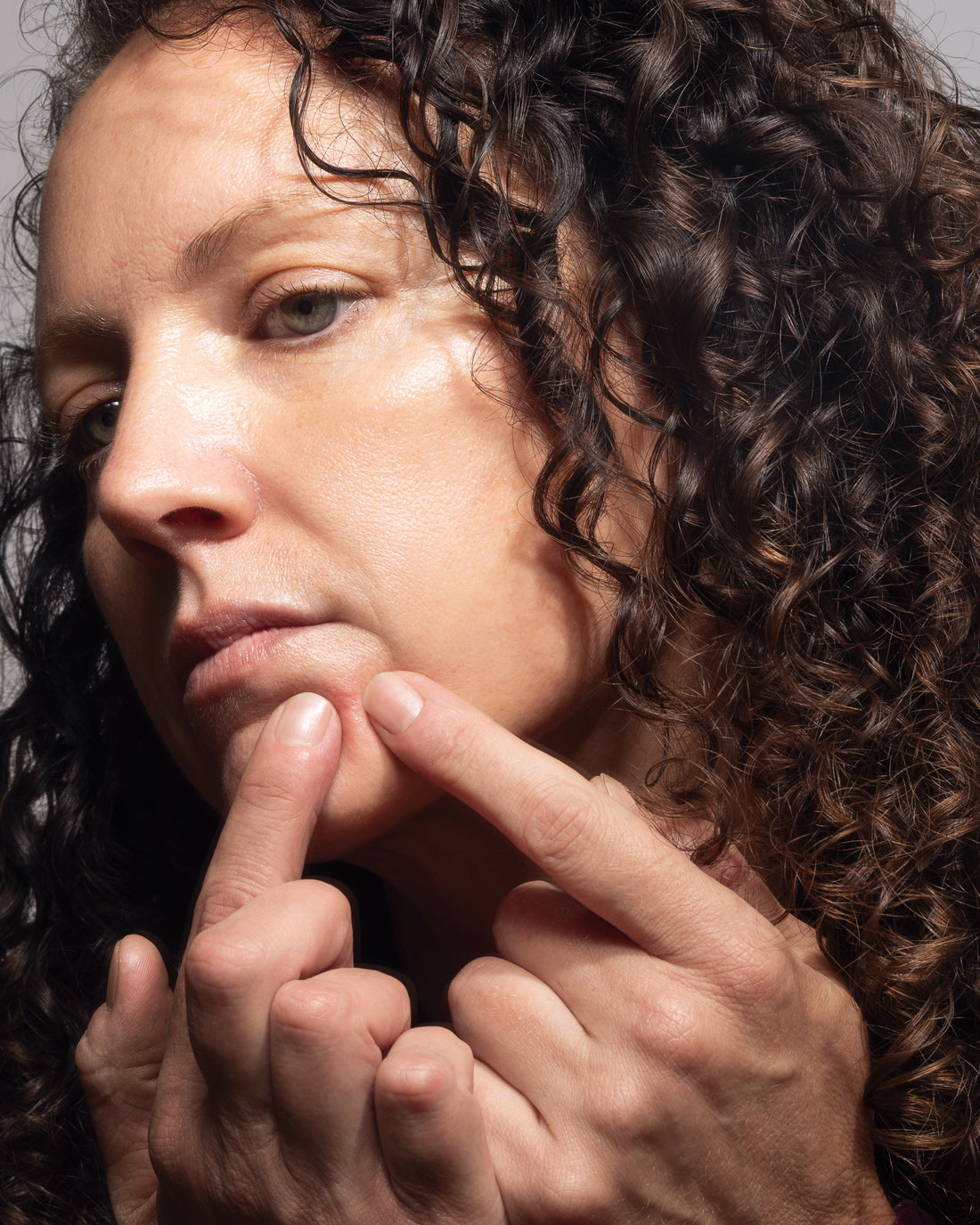 Hormonal Acne After 40: Why Perimenopause Brings Breakouts—and What Actually Works