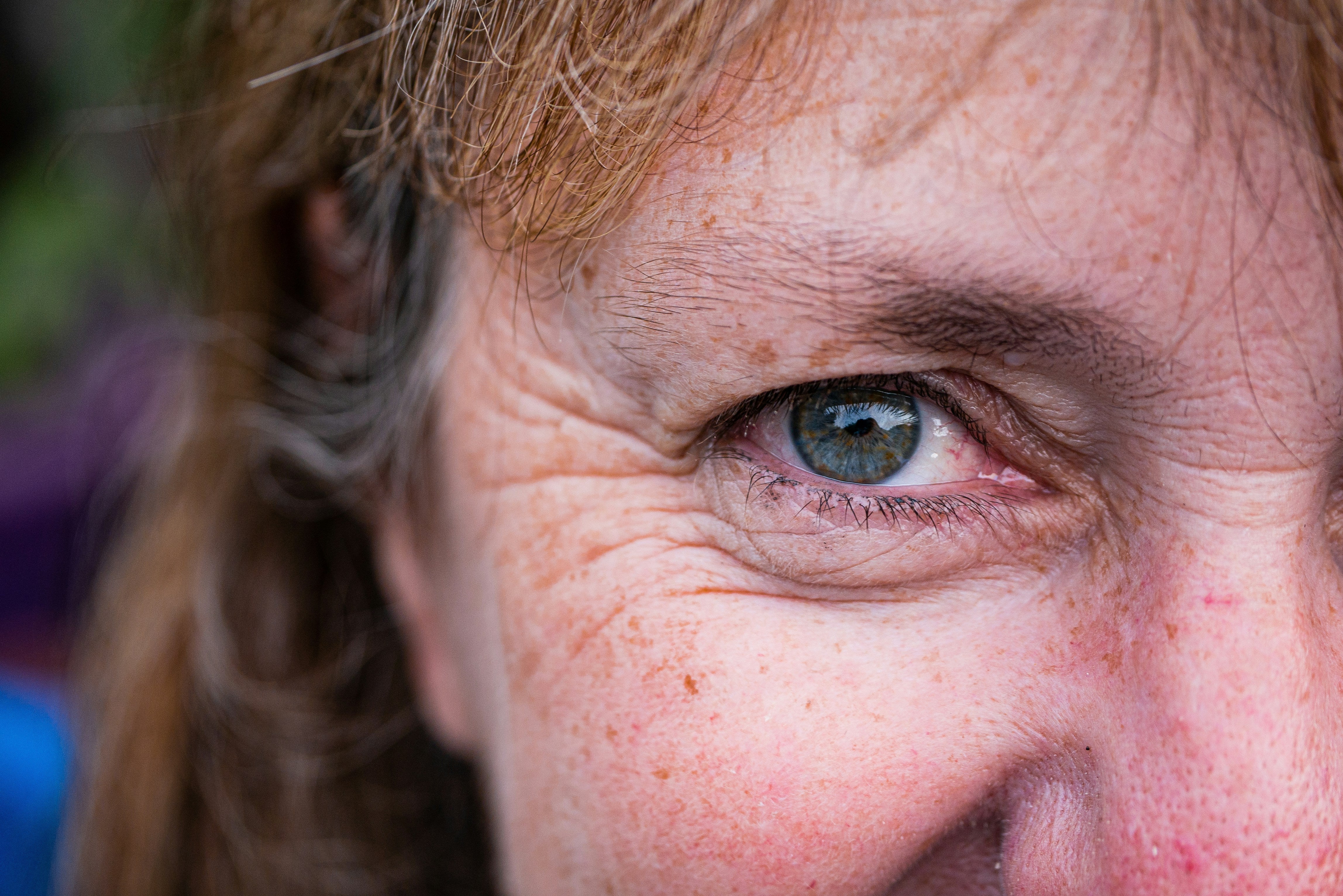 Why Environmental Damage Hits Harder After Menopause
